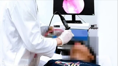 Bệnh nhi 14 tuổi mắc u xơ vòm mũi họng hiếm gặp