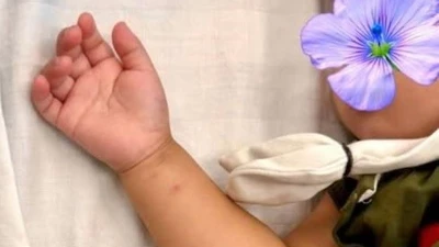 Tưởng kẹo thạch, trẻ hơn 2 tuổi uống nhầm thuốc diệt nấm