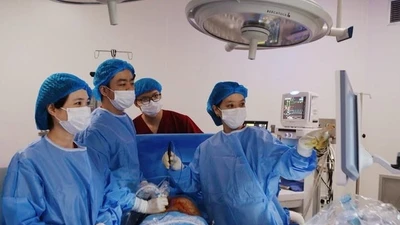 Điều trị thành công hội chứng song thai không tim