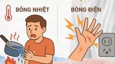 Nhiều ca bỏng nặng do sinh hoạt, người dân cần biết cách sơ cứu