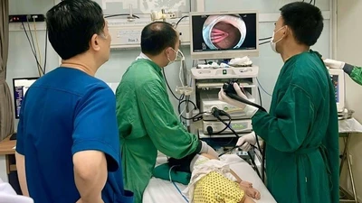Gắp dị vật kẹp tóc dài 5cm trong dạ dày bé gái 21 tháng tuổi