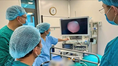 Bé sơ sinh 32 ngày tuổi mắc u nang hố lưỡi thanh thiệt khổng lồ hiếm gặp
