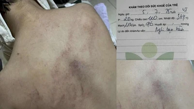 Bộ Y tế thông tin vụ nghi trẻ bị bạo hành tại Bồ Đề, Hà Nội