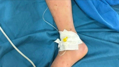 Nhiều trẻ tổn thương gan do dùng thuốc hạ sốt quá liều