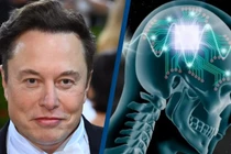 Neuralink của Elon Musk lập kỷ lục cấy chip não 1,5 giây