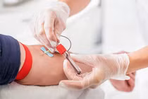 Hoang mang chiêu lừa mới nhắm vào người hiến máu