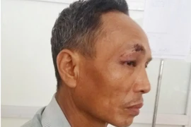 Dân tố bị công an đánh, Trưởng Công an huyện nói gì?