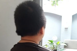Bé trai 12 tuổi nghi bị bố, dì ghẻ bạo hành: Đã có kết quả giám định