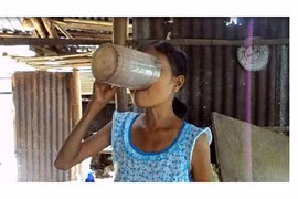 Bác sĩ giải mã bệnh ăn uống vô độ của cô gái Quảng Nam