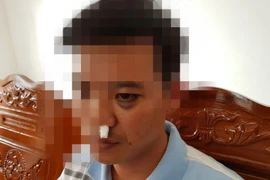 Tiết lộ nguyên nhân học sinh dẫn người vào trường đánh thầy giáo