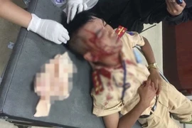 Lý lịch bất hảo đối tượng cầm đá đánh đại úy CSGT nhập viện