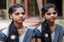 Ngôi làng kỳ lạ nhất Ấn Độ: 237 người ai cũng giống nhau