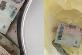 Hy hữu người phụ nữ nuốt 12,5 triệu đồng tiền polyme vào bụng