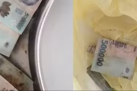 Hy hữu người phụ nữ nuốt 12,5 triệu đồng tiền polyme vào bụng