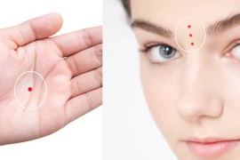 Nốt ruồi son ở vị trí này báo vận đỏ như son, tiền bạc rủng rỉnh