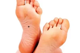 Bàn chân có 4 dấu hiệu này đều hưởng phúc khí sâu dày