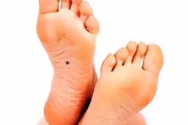 Bàn chân có 4 dấu hiệu này, đều hưởng phúc khí sâu