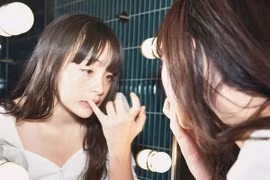 Ung thư rất dễ “ngụy trang” dưới hình dạng của 4 loại mụn này