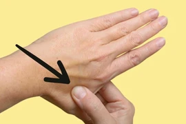 Đau đầu khó chịu, đây là mẹo giúp bạn có thể chấm dứt