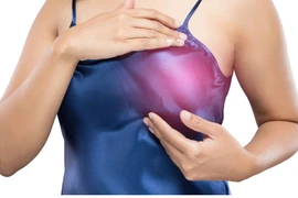 Loại ung thư tấn công phụ nữ nhiều nhất