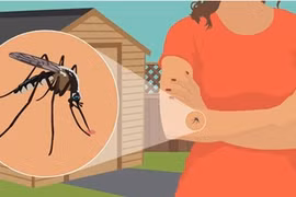 Cần tránh xa 4 màu quần áo này nếu không muốn bị muỗi đốt
