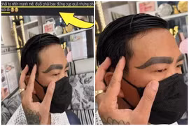 Đổi vận nhờ lông mày, nam thanh niên nhận cái kết quá “đớn đau“