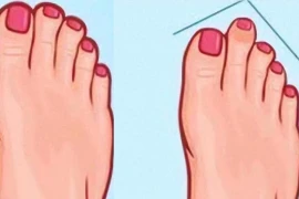 Trắc nghiệm tâm lý: Bàn chân của bạn có hình dạng nào sau đây? 