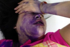 Chặn đánh, đổ mực tím vào mồm nạn nhân