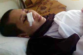 Sư thầy bỗng dưng bị đánh ngất xỉu