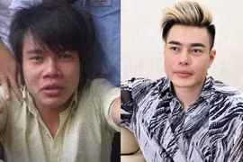 Lê Dương Bảo Lâm nghiện "dao kéo", 10 ngày đi thẩm mỹ một lần