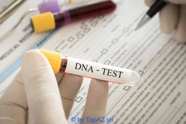 Vợ đổi mẫu tóc, chồng phải xét nghiệm ADN lần 2, kết quả bất ngờ