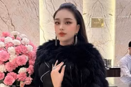 Gương mặt lạ hoắc của Lâm Khánh Chi: Nghi vấn dao kéo quá đà?