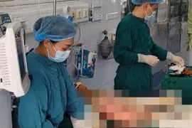 Vụ nổ gas ở Vĩnh Phúc: 5 nạn nhân bỏng nặng nguy kịch