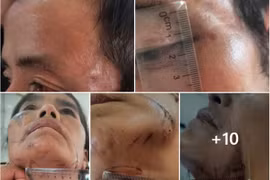 Thông tin mới vụ bắt giữ người trái pháp luật vì nghi bị bỏ bùa