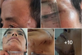 Thông tin mới vụ bắt giữ người trái pháp luật vì nghi bị bỏ bùa