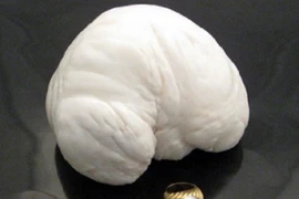 Thả neo vướng vào tảng đá, vô tình tìm được "báu vật" nghìn tỷ 