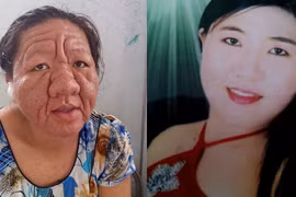 Bạc Liêu: Giật mình cô gái 29 tuổi biến thành bà lão 70
