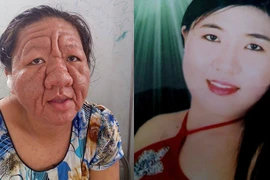 Bạc Liêu: Giật mình cô gái 29 tuổi biến thành bà lão 70