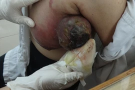 Thảm cảnh “người phụ nữ có 3 vú” ở Bình Dương