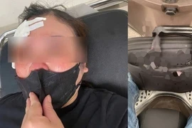 Nguyên nhân vụ người phụ nữ đi xe máy bị đánh vào đầu