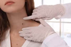 Loạt dấu hiệu cảnh báo có thể bạn đã bị ung thư