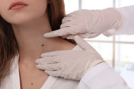 Loạt dấu hiệu cảnh báo có thể bạn đã bị ung thư