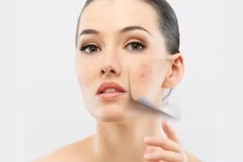 8 công thức mặt nạ trị khuyết điểm để da đẹp không tì vết