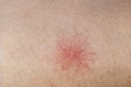 Có dấu hiệu này, đi khám ngay kẻo hại gan khó cứu vãn 