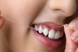 Sử dụng chỉ nha khoa làm sạch răng như thế nào mới đúng cách?