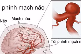 Bỏ qua cơn đau đầu, bé gái gục chết sau câu: “Con không khỏe!”
