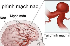 Bỏ qua cơn đau đầu, bé gái gục chết sau câu: “Con không khỏe!”