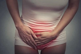 Phụ nữ có những dấu hiệu này có thể đã bị ung thư âm hộ