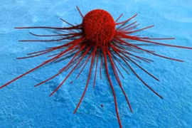 Khám phá quá trình di căn của tế bào ung thư