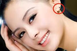 3 vị trí nốt ruồi mang số mệnh giàu có, đặc biệt số 1